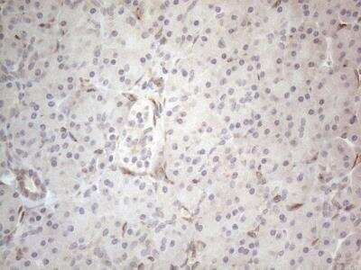 Immunohistochemistry: RBMS1 Antibody (OTI2H1) [NBP2-45533]