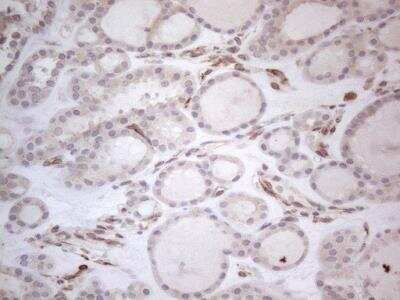 Immunohistochemistry: RBMS1 Antibody (OTI2H1) [NBP2-45533]