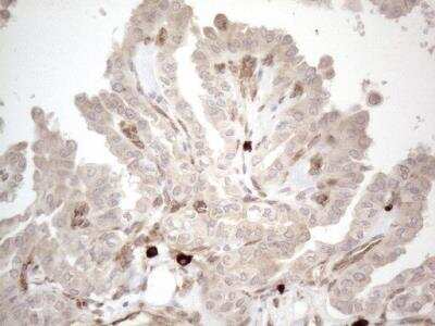 Immunohistochemistry: RBMS1 Antibody (OTI2H1) [NBP2-45533]