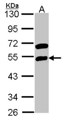 Western Blot: RBMS1 Antibody [NBP2-20111]