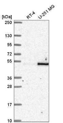 Western Blot: RBMS1 Antibody [NBP2-57279]