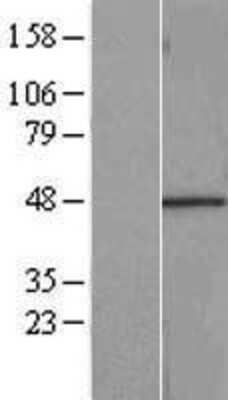 Western Blot: RBMS1 Overexpression Lysate [NBL1-15219]