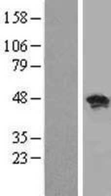 Western Blot: RBMS1 Overexpression Lysate [NBL1-15220]