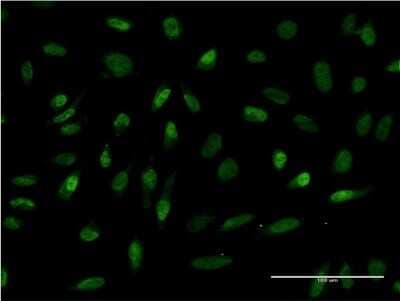 Immunocytochemistry/ Immunofluorescence: RBMS2 Antibody (3B2) [H00005939-M03]