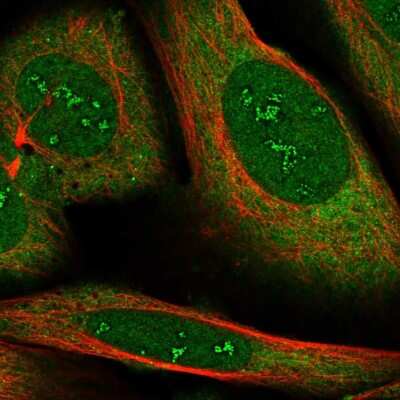 Immunocytochemistry/ Immunofluorescence: RBMS2 Antibody [NBP2-55471]