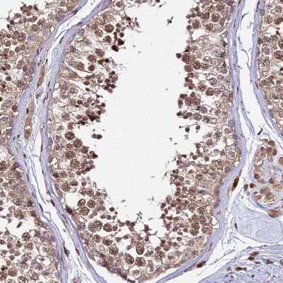Immunohistochemistry-Paraffin: RBMS2 Antibody [NBP1-92321]