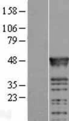 Western Blot: RBMS2 Overexpression Lysate [NBL1-15221]