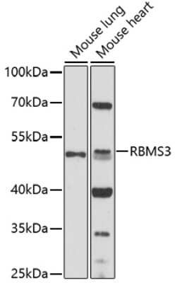 Western Blot: RBMS3 AntibodyAzide and BSA Free [NBP2-93103]