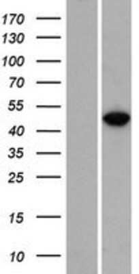 Western Blot: RBMS3 Overexpression Lysate [NBP2-08921]