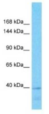 Western Blot: RBMXL1 Antibody [NBP3-09885]