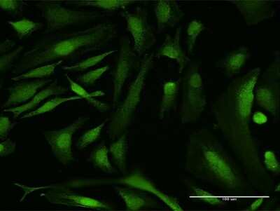 Immunocytochemistry/ Immunofluorescence: RBMY1A1 Antibody [H00005940-B01P]
