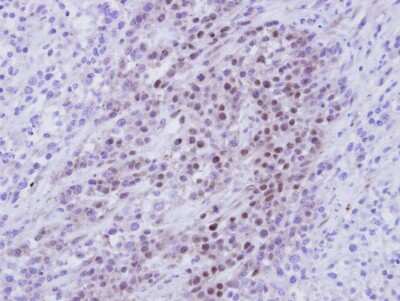 Immunohistochemistry-Paraffin: RBMY1A1 Antibody [NBP1-32887]