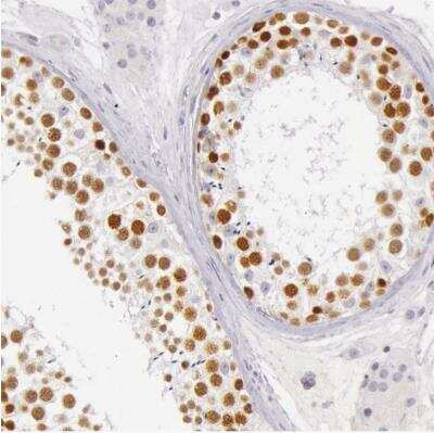 Immunohistochemistry-Paraffin: RBMY1A1 Antibody [NBP2-54662]