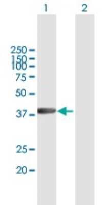 Western Blot: RBMY1A1 Antibody [H00005940-B01P]