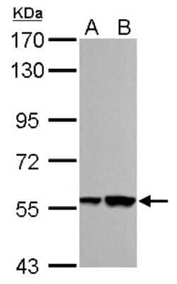 Western Blot: RBMY1A1 Antibody [NBP1-32887]