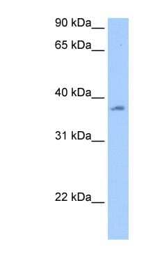 Western Blot: RBMY1A1 Antibody [NBP1-57363]