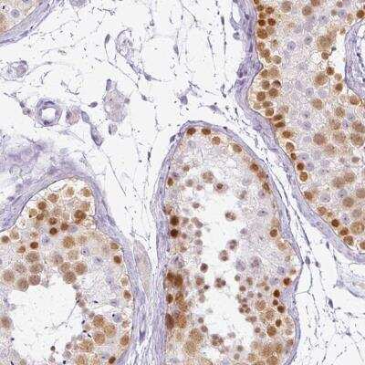 Immunohistochemistry: RBMY1F Antibody [NBP2-46812]