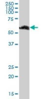 Western Blot: RBMY1F Antibody [H00159163-B01P]