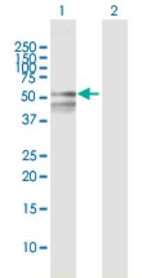 Western Blot: RBMY1F Antibody [H00159163-B01P]