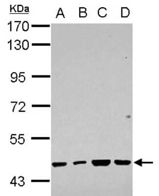 Western Blot: RBMY1F Antibody [NBP2-15093]