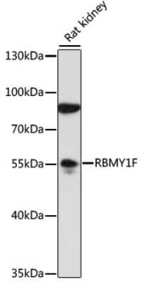 Western Blot: RBMY1F AntibodyAzide and BSA Free [NBP2-94712]