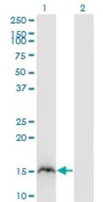 Western Blot: RBP2 Antibody (3G12) [H00005948-M02]