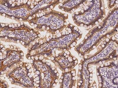 Immunohistochemistry-Paraffin: RBP2 Antibody [NBP2-97451]