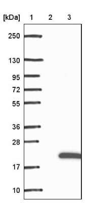 Western Blot: RBP2 Antibody [NBP1-85464]