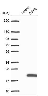 Western Blot: RBP2 Antibody [NBP1-85464]