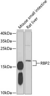 Western Blot: RBP2 AntibodyBSA Free [NBP2-94108]