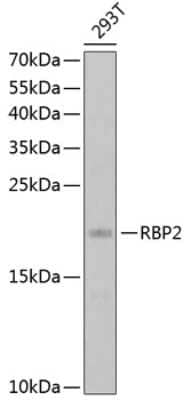 Western Blot: RBP2 AntibodyBSA Free [NBP2-94128]