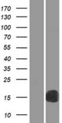 Western Blot: RBP2 Overexpression Lysate [NBP2-07902]