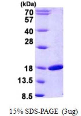 SDS-PAGE: Recombinant Human RBP2 His Protein [NBP2-23413]