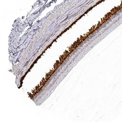 Immunohistochemistry-Paraffin: RBP3 Antibody [NBP2-58200]