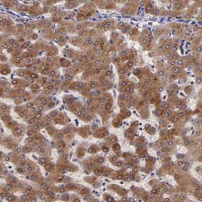 Immunohistochemistry-Paraffin: RBP4/Retinol-Binding Protein 4 Antibody [NBP1-86173]