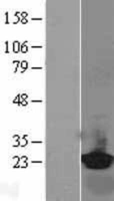 Western Blot: RBP4/Retinol-Binding Protein 4 Overexpression Lysate [NBL1-15228]