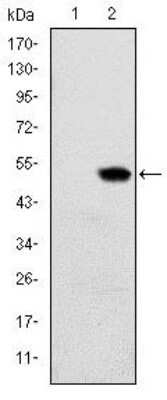 Western Blot: RBP4/Retinol-Binding Protein 4 Antibody (4C2)BSA Free [NBP2-37614]