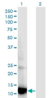 Western Blot: RBP5 Antibody (2D1) [H00083758-M05]