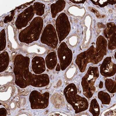 Immunohistochemistry-Paraffin: RBP5 Antibody [NBP2-32643]