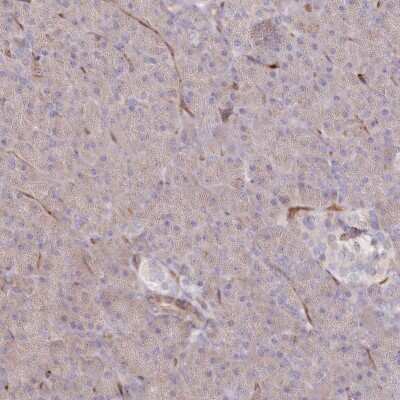 Immunohistochemistry-Paraffin: RBP5 Antibody [NBP2-32643]