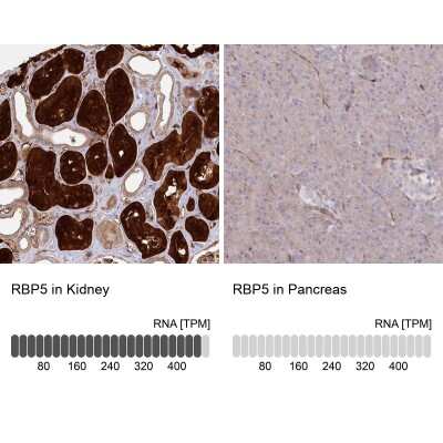 Immunohistochemistry-Paraffin: RBP5 Antibody [NBP2-32643]