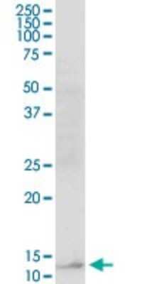 Western Blot: RBP5 Antibody [H00083758-B01P]