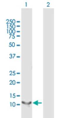 Western Blot: RBP5 Antibody [H00083758-B01P]