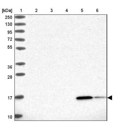 Western Blot: RBP5 Antibody [NBP2-32643]