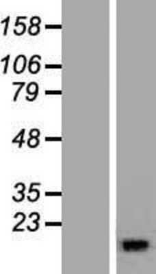 Western Blot: RBP5 Overexpression Lysate [NBL1-15229]