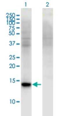 Western Blot: RBP7 Antibody (4F4) [H00116362-M01]