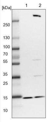 Western Blot: RBP7 Antibody [NBP1-84383]