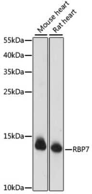 Western Blot: RBP7 AntibodyAzide and BSA Free [NBP2-94436]