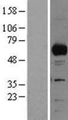 Western Blot: csl/RBPJK Overexpression Lysate [NBL1-15231]