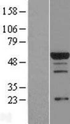 Western Blot: csl/RBPJK Overexpression Lysate [NBL1-15233]